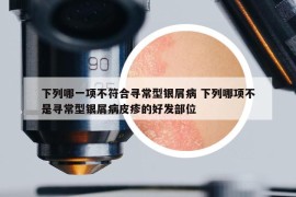 下列哪一项不符合寻常型银屑病 下列哪项不是寻常型银屑病皮疹的好发部位