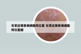 石家庄银屑病病医院位置 石家庄银屑病病医院位置图