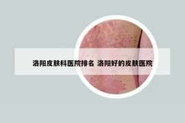 洛阳皮肤科医院排名 洛阳好的皮肤医院