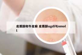 皮质醇和牛皮癣 皮质醇ugdl与nmoll