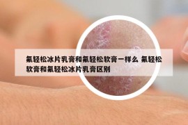 氟轻松冰片乳膏和氟轻松软膏一样么 氟轻松软膏和氟轻松冰片乳膏区别