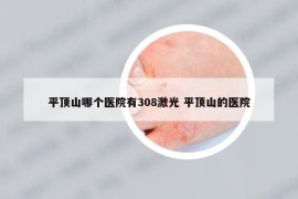 平顶山哪个医院有308激光 平顶山的医院