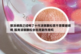 银消病我己经喝了十代消银颗粒需不需要继续喝 服用消银颗粒会出现副作用吗