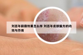 刘百年藓霸效果怎么样 刘百年皮肤偏方的功效与作用
