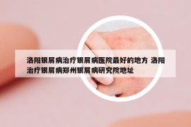 洛阳银屑病治疗银屑病医院最好的地方 洛阳治疗银屑病郑州银屑病研究院地址
