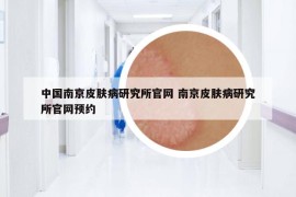 中国南京皮肤病研究所官网 南京皮肤病研究所官网预约