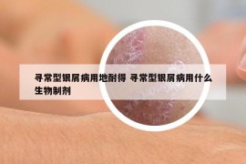 寻常型银屑病用地耐得 寻常型银屑病用什么生物制剂