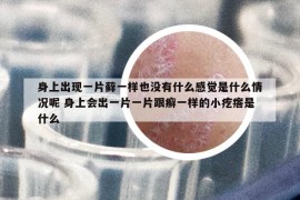 身上出现一片藓一样也没有什么感觉是什么情况呢 身上会出一片一片跟癣一样的小疙瘩是什么