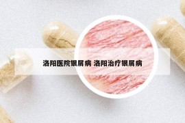 洛阳医院银屑病 洛阳治疗银屑病