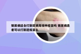 银屑病适合打新冠病毒接种疫苗吗 银屑病患者可以打新冠疫苗么