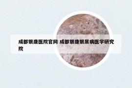 成都银康医院官网 成都银康银屑病医学研究院