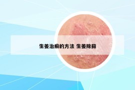 生姜治癣的方法 生姜除藓