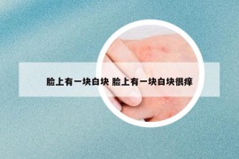 脸上有一块白块 脸上有一块白块很痒