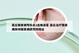 商丘银屑病专科去z选杨淑莲 商丘治疗银屑病郑州银屑病研究院地址