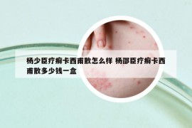 杨少臣疗癣卡西甫散怎么样 杨邵臣疗癣卡西甫散多少钱一盒