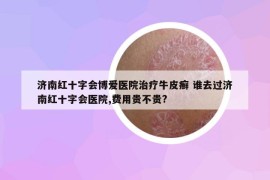 济南红十字会博爱医院治疗牛皮癣 谁去过济南红十字会医院,费用贵不贵?