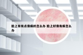 脸上有有点像癣的怎么办 脸上好像有癣怎么办