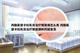 丙酸氟替卡松乳膏治疗银屑病怎么用 丙酸氟替卡松乳膏治疗银屑病停药就复发