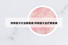 转移因子针治银屑病 转移因子治疗银屑病