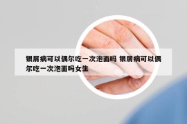 银屑病可以偶尔吃一次泡面吗 银屑病可以偶尔吃一次泡面吗女生
