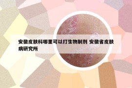 安徽皮肤科哪里可以打生物制剂 安徽省皮肤病研究所