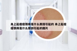身上起痘痘很痒是什么原因引起的 身上起痘痘很痒是什么原因引起的图片