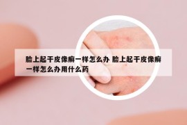 脸上起干皮像癣一样怎么办 脸上起干皮像癣一样怎么办用什么药