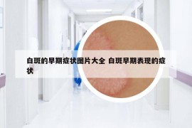 白斑的早期症状图片大全 白斑早期表现的症状