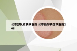 长春部队皮肤病医院 长春最好的部队医院208
