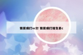 银屑病打vc针 银屑病打维生素c