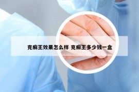 克癣王效果怎么样 克癣王多少钱一盒