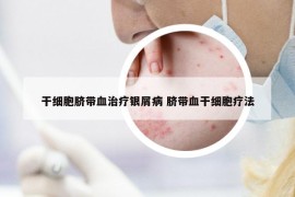 干细胞脐带血治疗银屑病 脐带血干细胞疗法