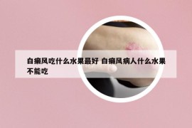 白癞风吃什么水果最好 白癞风病人什么水果不能吃