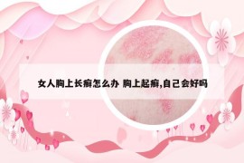 女人胸上长癣怎么办 胸上起癣,自己会好吗