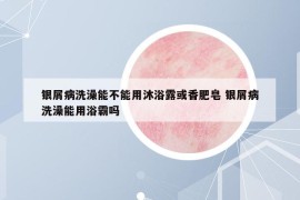 银屑病洗澡能不能用沐浴露或香肥皂 银屑病洗澡能用浴霸吗