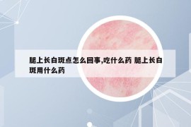 腿上长白斑点怎么回事,吃什么药 腿上长白斑用什么药