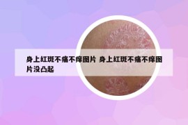 身上红斑不痛不痒图片 身上红斑不痛不痒图片没凸起