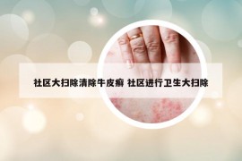社区大扫除清除牛皮癣 社区进行卫生大扫除