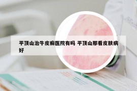 平顶山治牛皮癣医院有吗 平顶山那看皮肤病好
