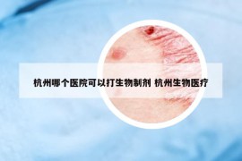 杭州哪个医院可以打生物制剂 杭州生物医疗