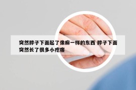 突然脖子下面起了像癣一样的东西 脖子下面突然长了很多小疙瘩