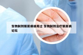 生物制剂银屑病谁用过 生物制剂治疗银屑病论坛