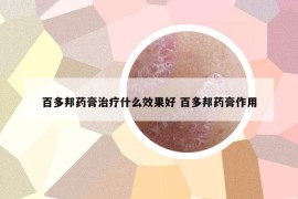 百多邦药膏治疗什么效果好 百多邦药膏作用