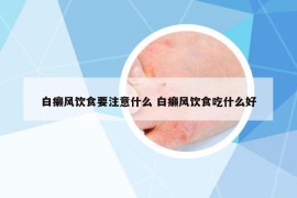 白癞风饮食要注意什么 白癞风饮食吃什么好