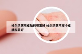 哈尔滨医院皮肤科哪家好 哈尔滨医院哪个皮肤科最好