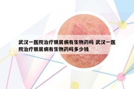 武汉一医院治疗银屑病有生物药吗 武汉一医院治疗银屑病有生物药吗多少钱