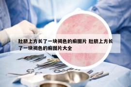 肚脐上方长了一块褐色的癣图片 肚脐上方长了一块褐色的癣图片大全