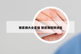 银屑病大会直播 银屑病视频讲座