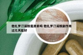 他扎罗汀凝胶是激素吗 他扎罗汀凝胶副作用过几天能好