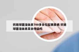 抗链球菌溶血素700多会引起银屑病 抗链球菌溶血素高会传染吗